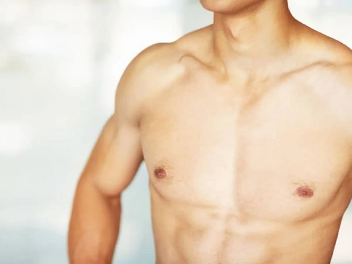 Saggy Gynecomastia treatment outlined by specialist Dr. Cruise
