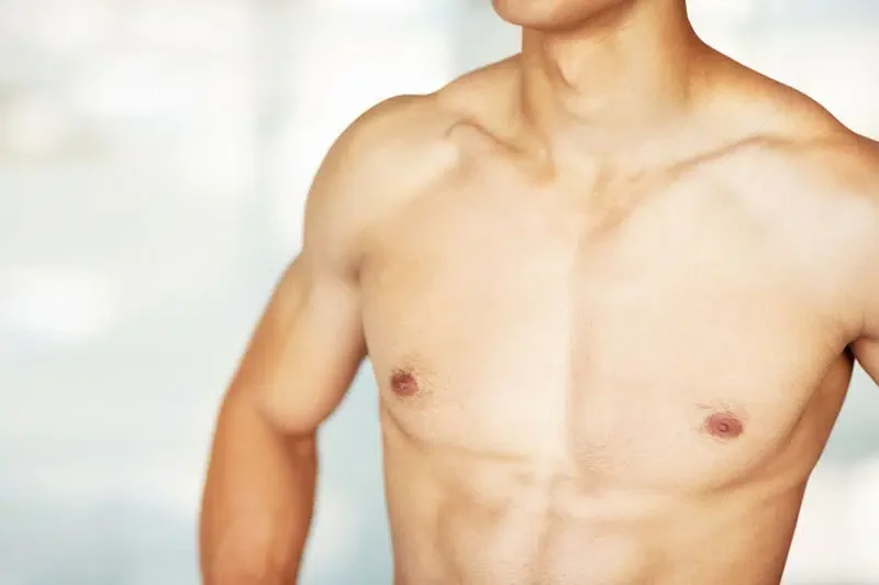 male breast reduction gynecomastia UK