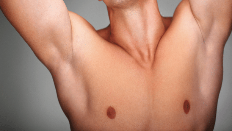 How To Prepare For Gynecomastia Surgery