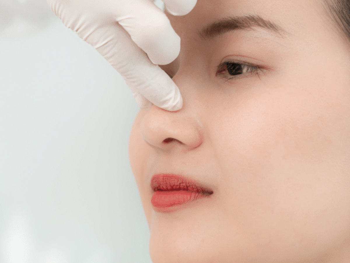 Non-Surgical Nose Reshaping: A Trend on the Rise