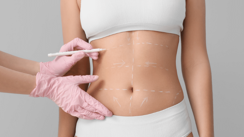 Tumescent Liposuction vs. BodyTite