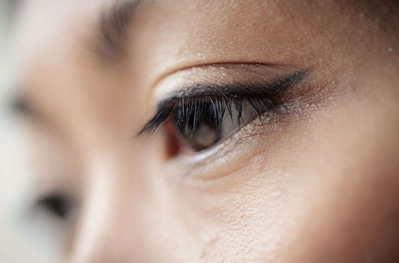 What Is Asian Blepharoplasty Centre For Surgery   Asianblepharoplasty 