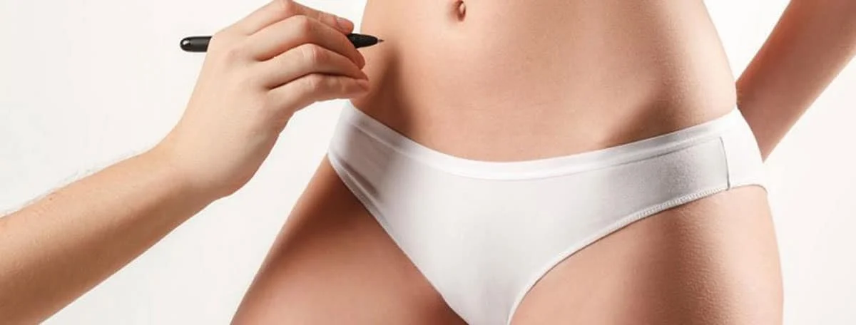 How Much Weight Can Be Lost from a Tummy Tuck?