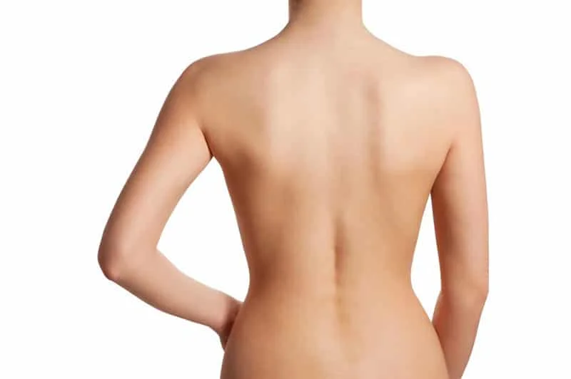The Ultimate Guide on Bra Roll Liposuction
