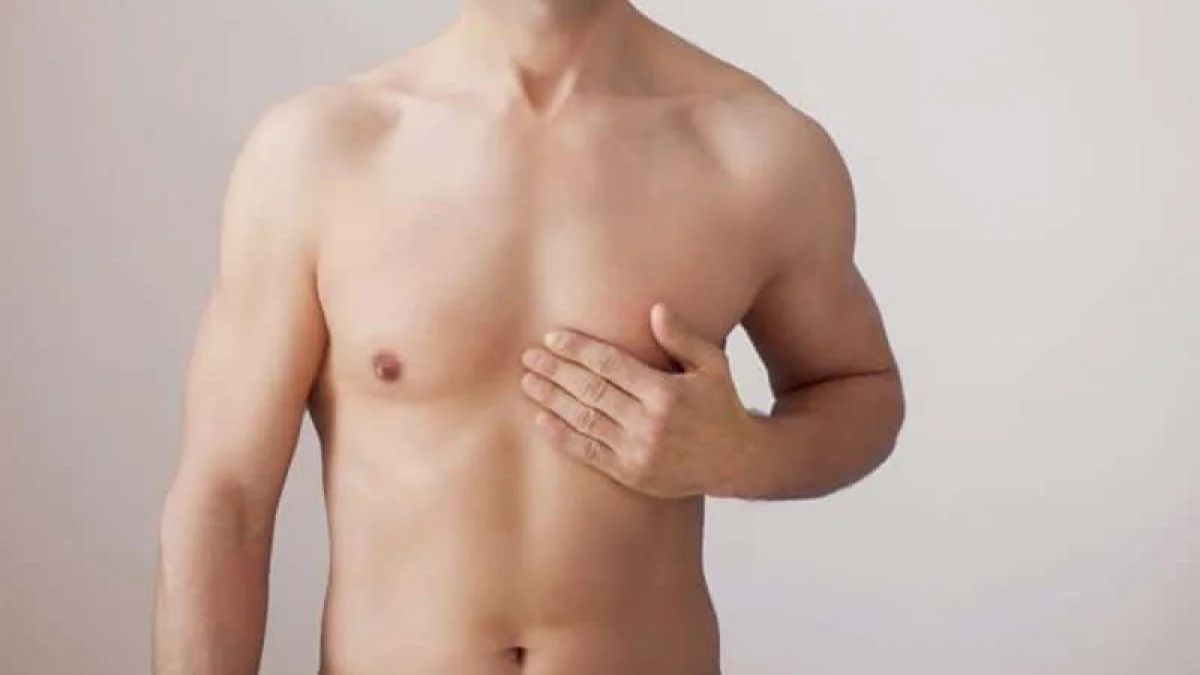 Third Nipple (Supernumerary Nipple): Causes, Types & Removal