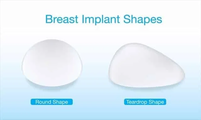 Breast Augmentation