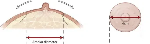 areola dimensions