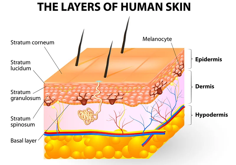 chemical peels human skin