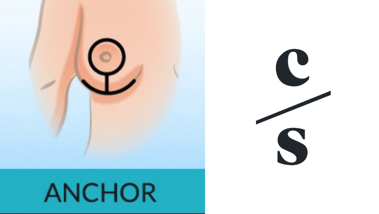 Anchor Scar Incision Centre for Surgery London
