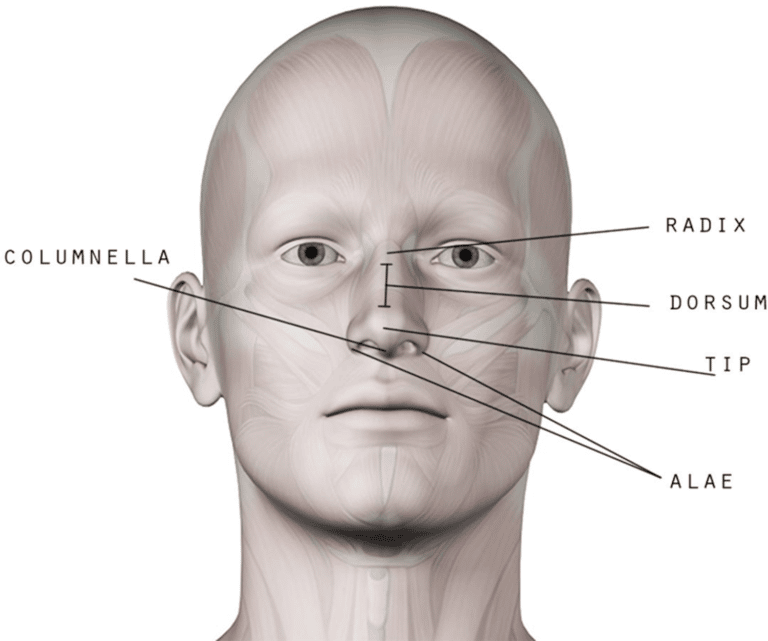 alar base reduction alarplasty facial dimensions