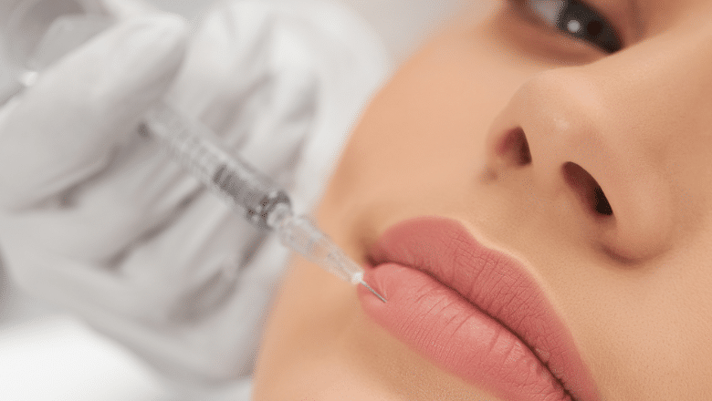lip filler injections London