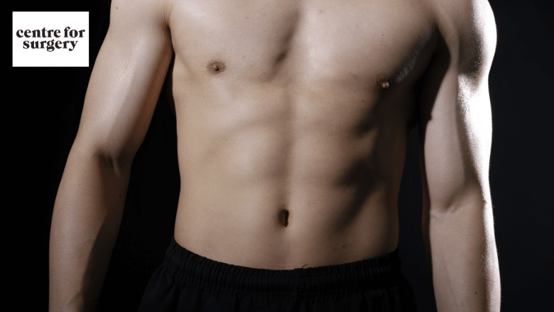 male tummy tuck abdominoplasty London UK