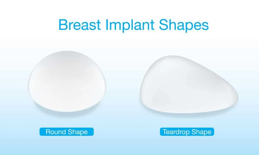 3 Benefits of Tear Drop Breast Implants - Dr. York Yates Plastic