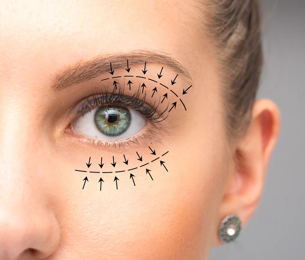 benefits of eyelid surgery