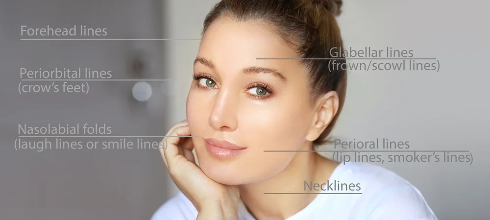 dermal filler treatment areas