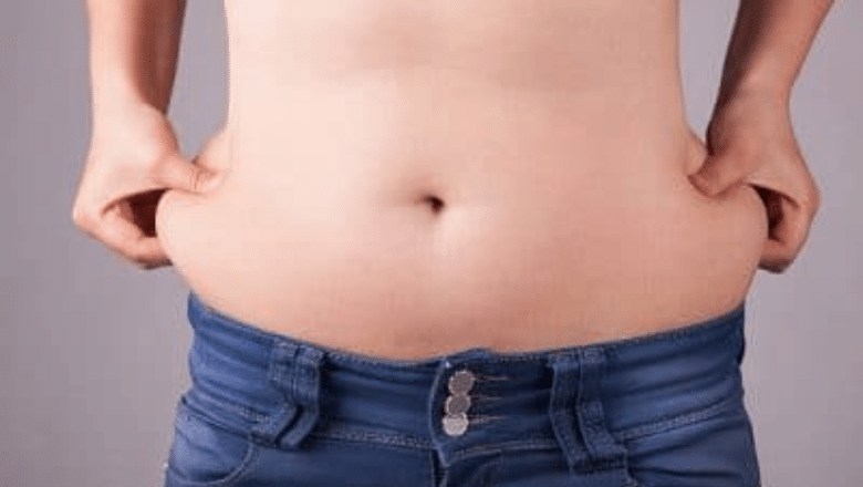 What is 'Muffin Top' Liposuction