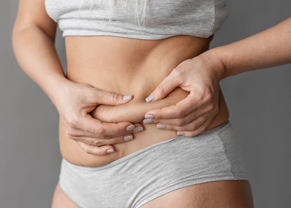 how to get rid of belly fat with liposuction