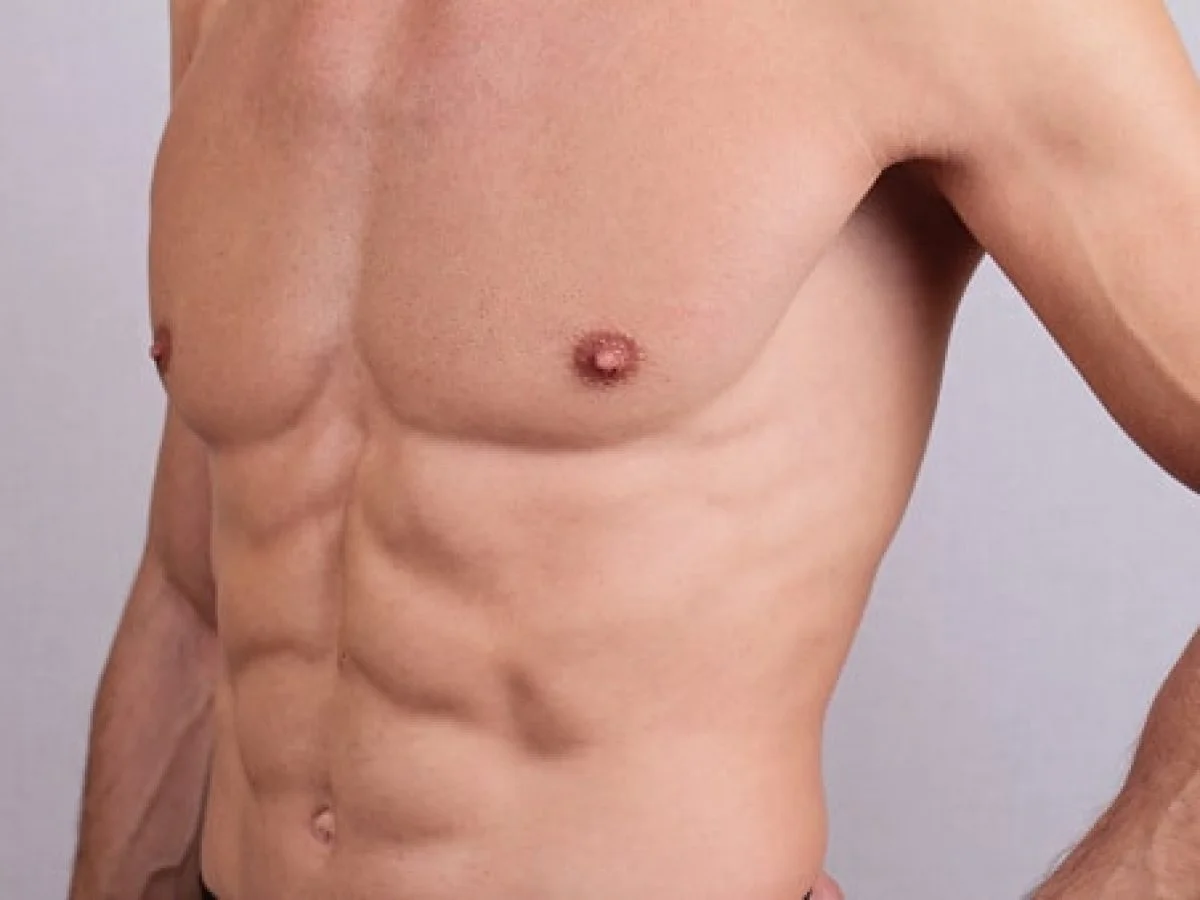 Recovery After Gynecomastia Surgery - What to Expect | Centre for Surgery