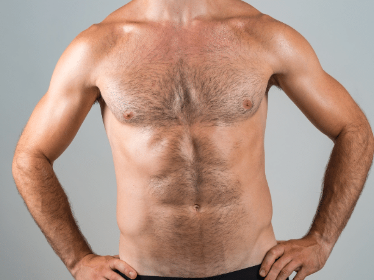 Gynecomastia vs Fat How to Tell the Difference Gyno or Chest Fat