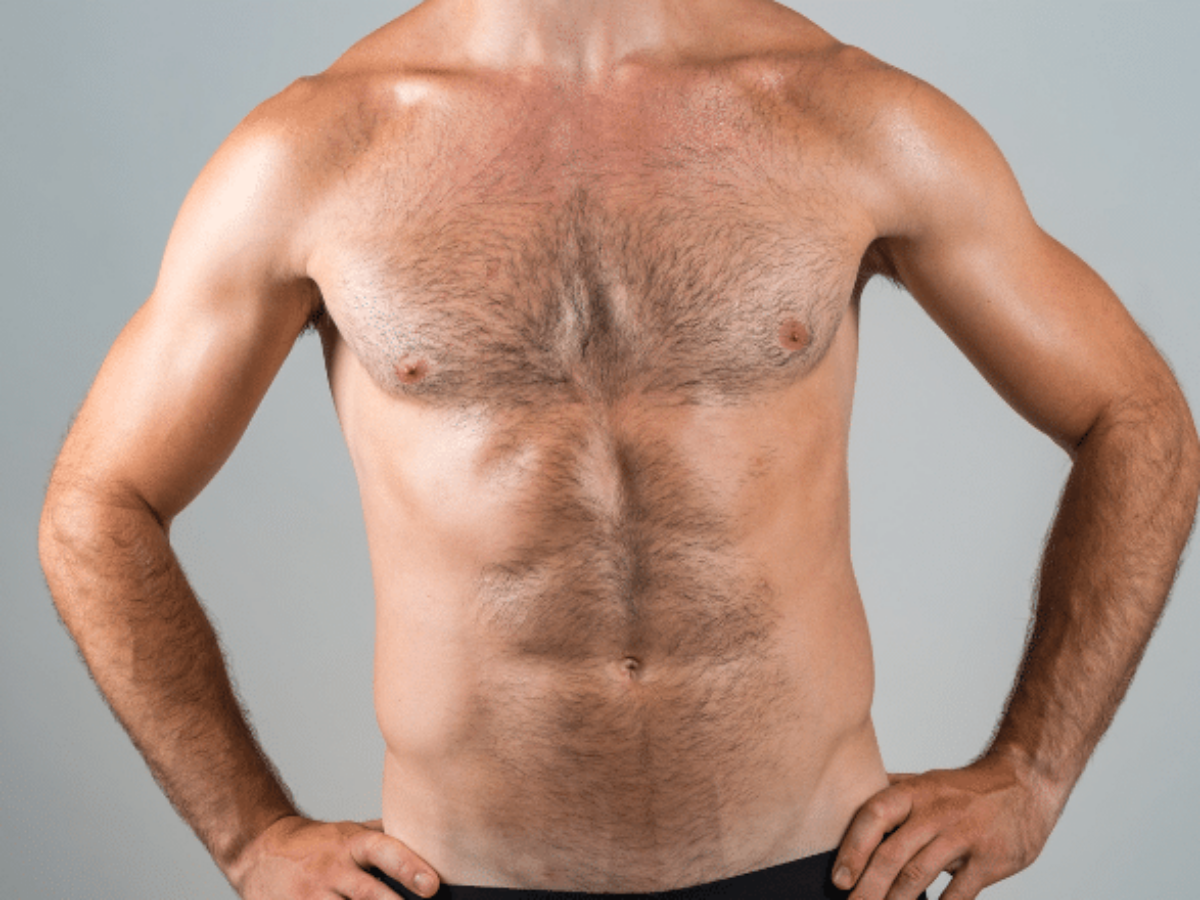 Gynecomastia vs Fat - How to Tell the Difference