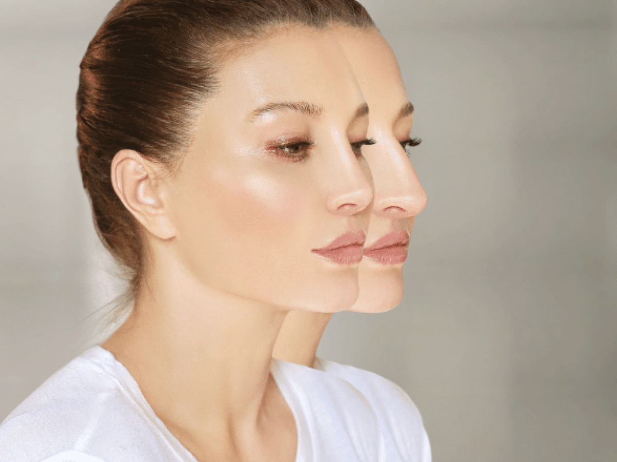 How Much Does A Nose Job or Rhinoplasty Cost Centre for Surgery