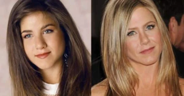 jennifer aniston nose job