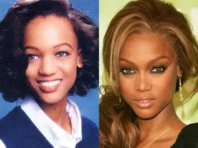 tyra banks nose job