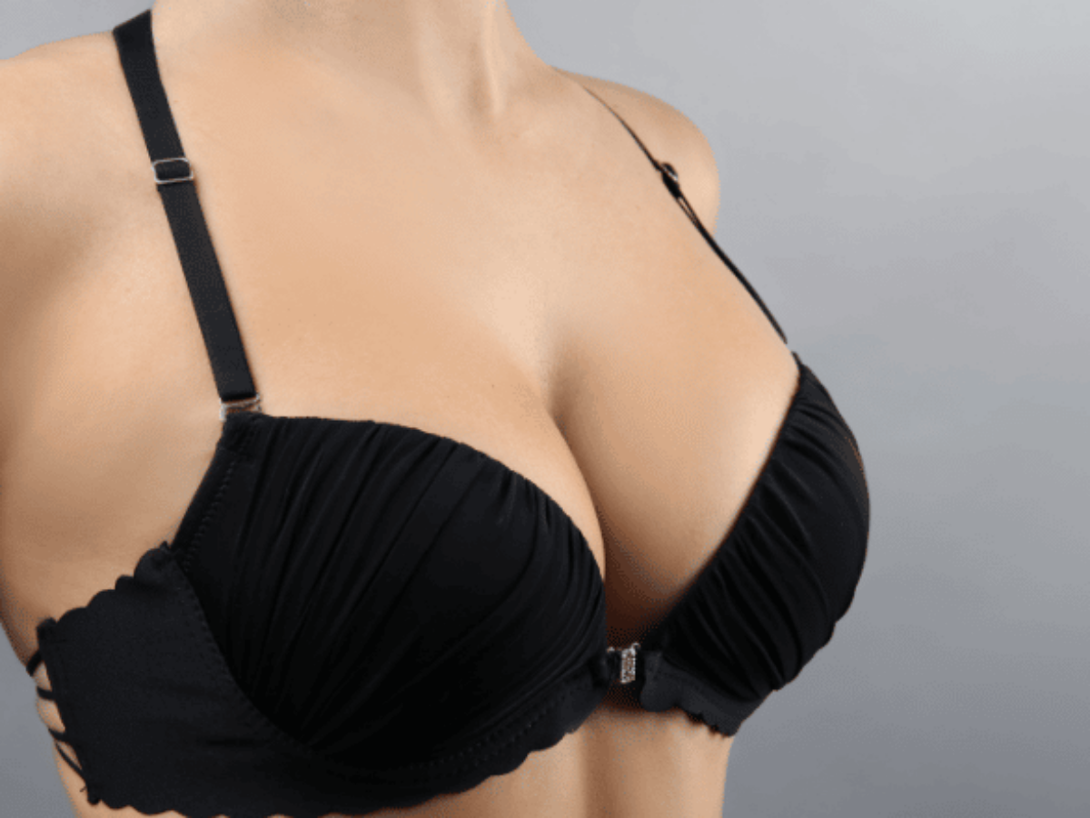 Breast Reduction Support South Africa - Very important info for