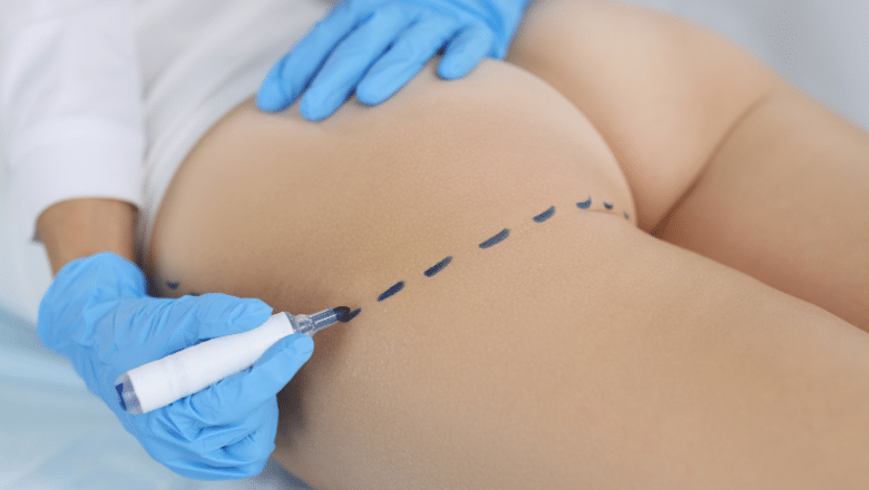 bum injections procedure