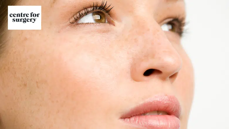 sunken cheeks - Causes & Treatments London UK