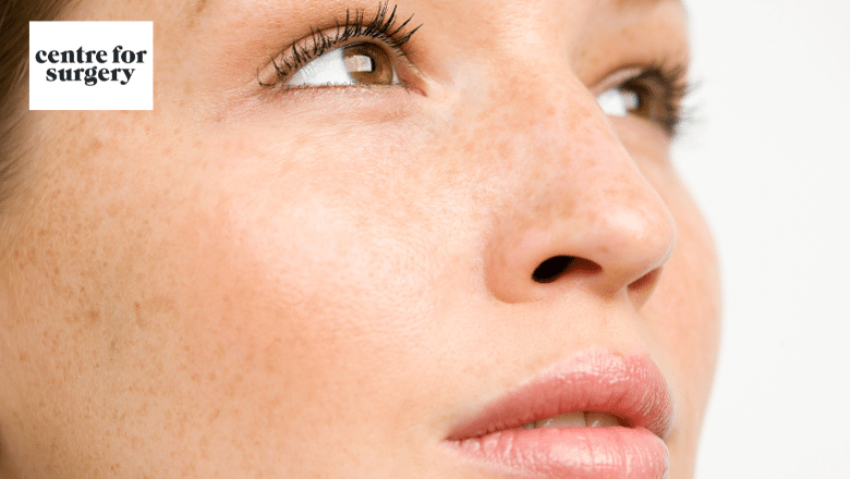 sunken cheeks - Causes & Treatments London UK