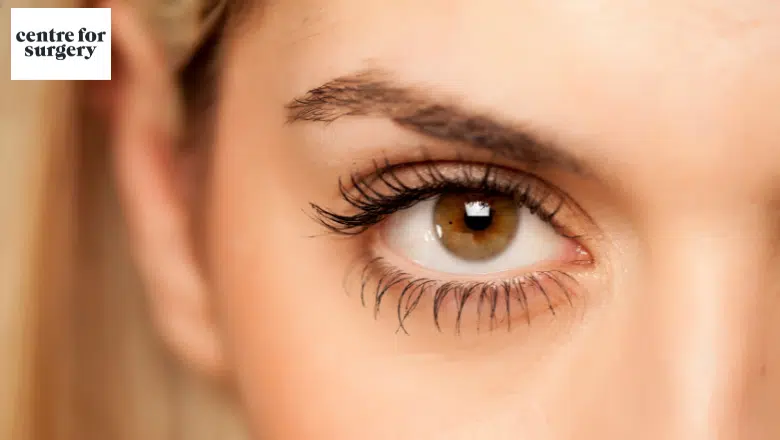 laser blepharoplasty London UK