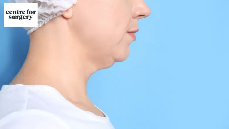 double-chin-surgery-London.png.webp?format=webp&nv=212368fc-2000-40d1-9026-c0f94abda644