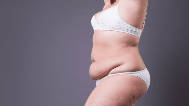 Treating Excess Fat In The Pubic Area (FUPA) - Westlake Dermatology