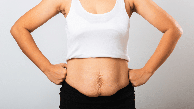 Body Shaping Surgery after Massive Weight Loss 