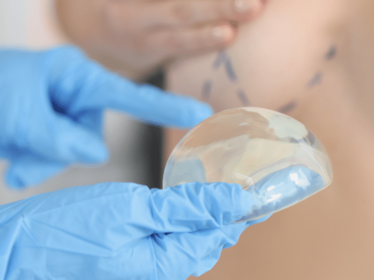 How to Prepare For Your Breast Augmentation Consultation Centre