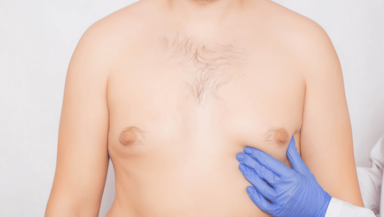 Male Breast Reduction Without Scars