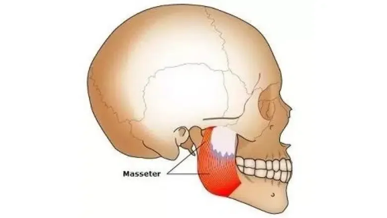 masseter-injections-jaw-slimming.png.webp?format=webp&amp;nv=212368fc-2000-40d1-9026-c0f94abda644