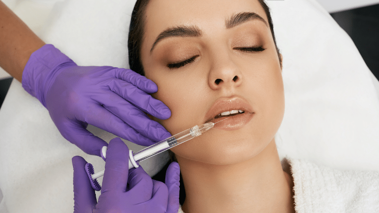 4 Things to Know About Lip Filler Injections