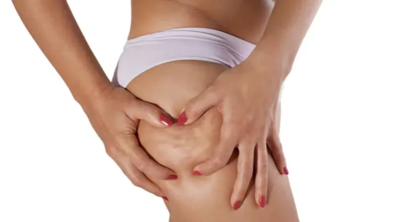 Cellulite Treatment Options London UK