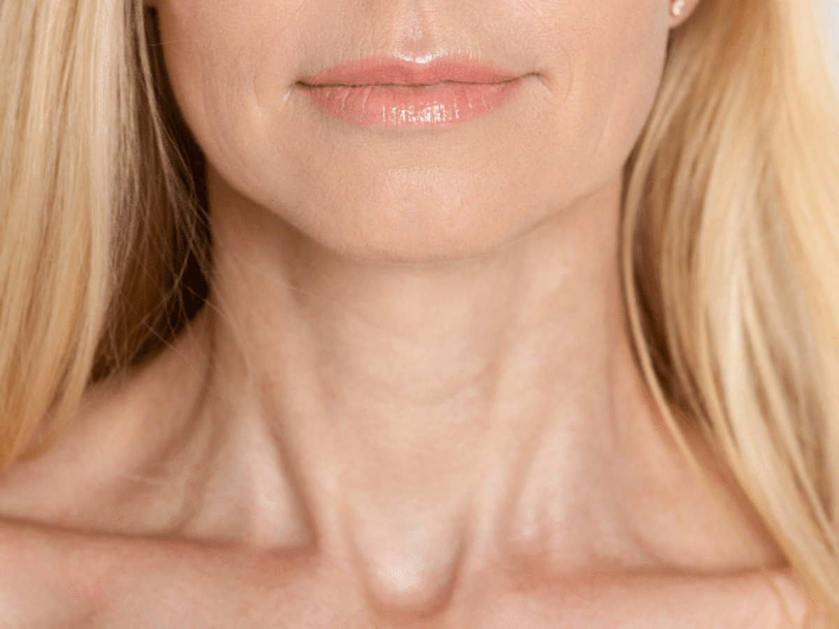 How to Use Vaseline to Get Rid of Neck and Chest Wrinkles and Crepe Skin