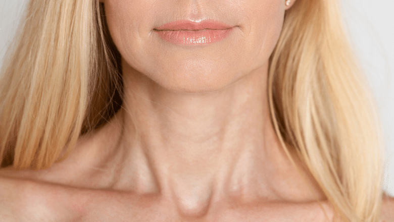 How to Get Rid of Neck Lines