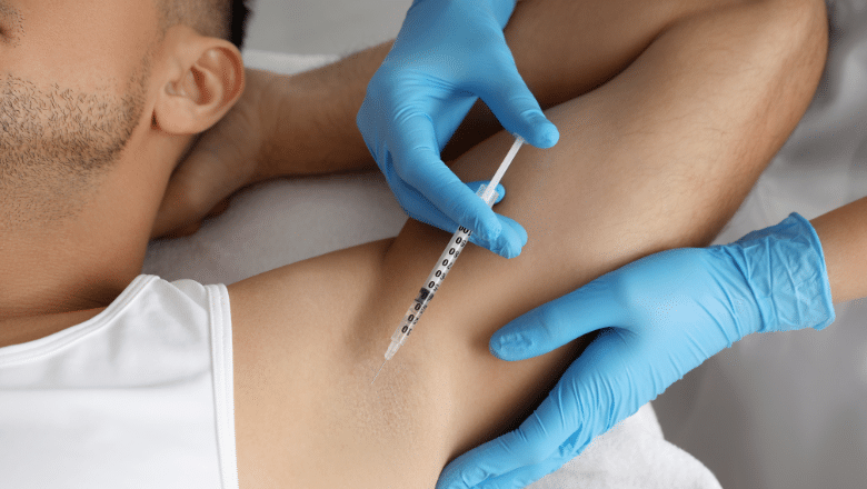 Non Surgical Treatments for Excessive Armpit Sweating