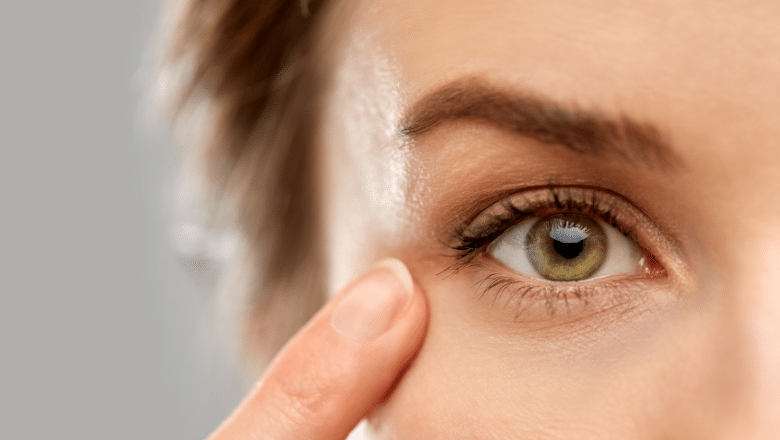 Veins Under Eyes Laser Treatment London & UK