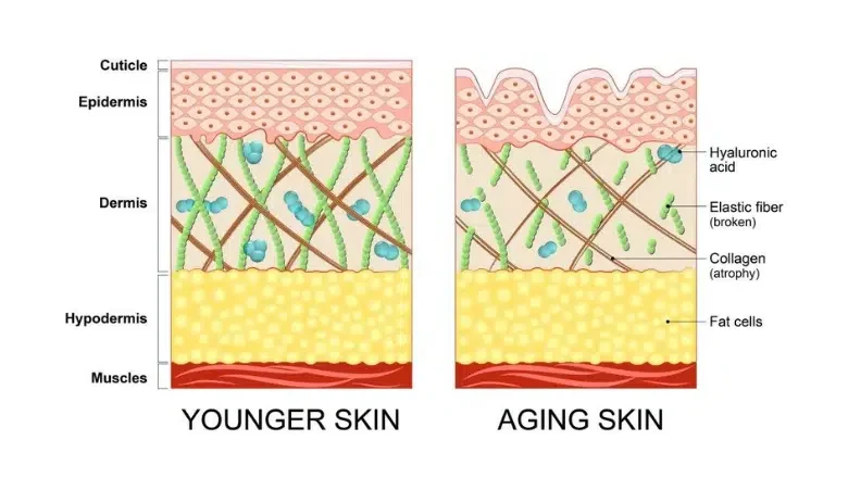 facial ageing process