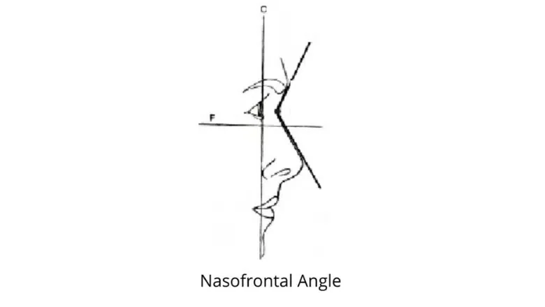 nasofrontal angle