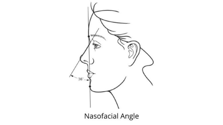 nasofacial angle