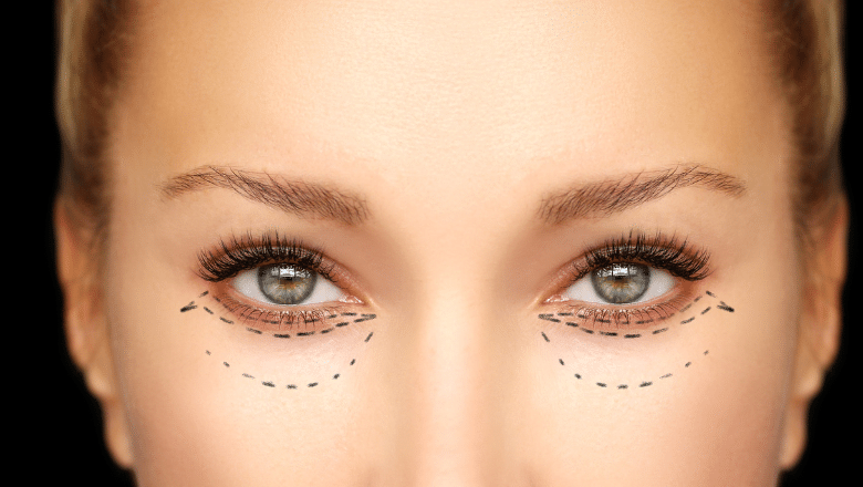 Blepharoplasty Surgery Risks - Eyelid Surgery Risks & Complications