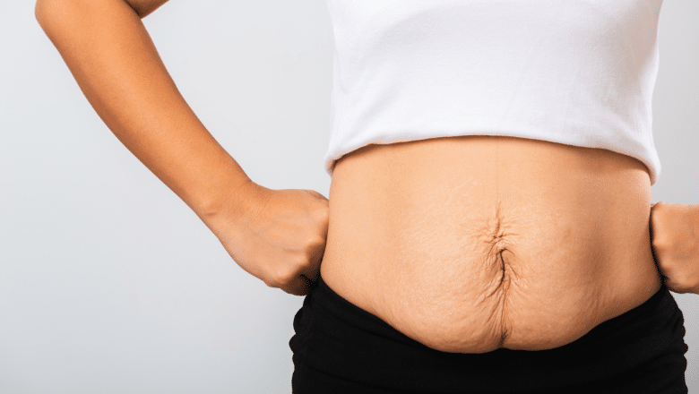 Body Lift Surgery After Massive Weight Loss