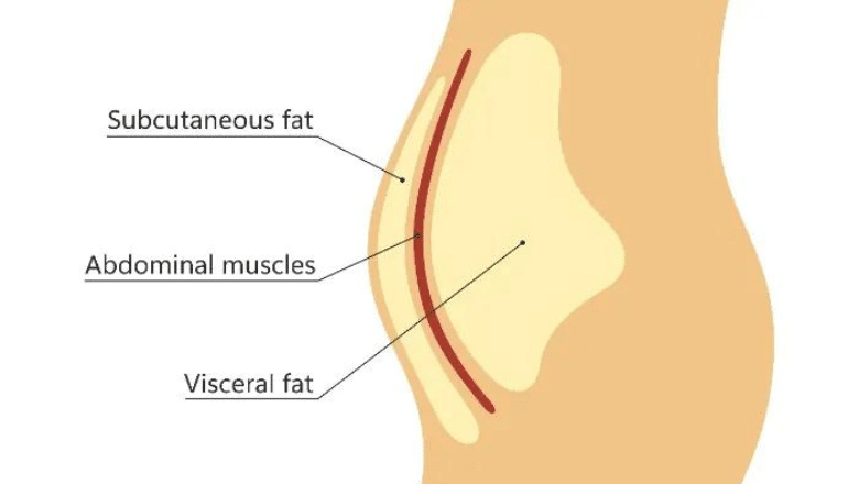 Different Types of Fat Distribution